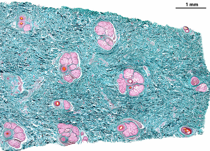Human skin dermis, light micrograph Light micrograph showing the dermis of the thin skin. Among the collagen fibres  green  several cross sectioned pilosebaceous units can be seen, showing, at centre, the hair surrounded by sebaceous glands. Gomori stain. The scale bar corresponds to 1 mm., by JOSE CALVO   SCIENCE PHOTO LIBRARY