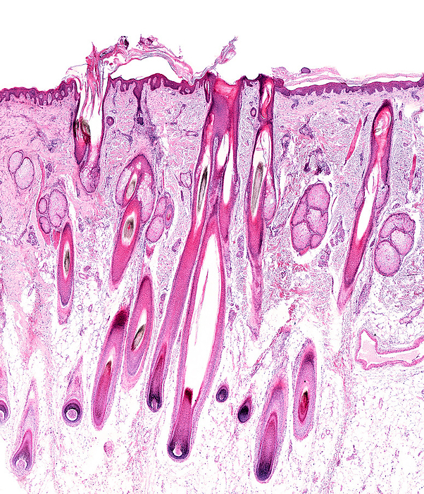 Human scalp, light micrograph Light micrograph of human scalp skin showing hair follicles with their associated sebaceous glands  pilosebaceous units . Melanin can be seen in hair matrix and hair shafts., by JOSE CALVO   SCIENCE PHOTO LIBRARY