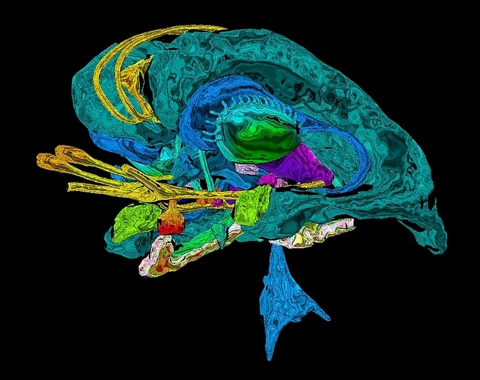 Limbic system in Alzheimer s disease, 3D MRI scan Coloured 3D magnetic resonance imaging  MRI  scan of the limbic system of the brain of a patient with Alzheimer s disease. Alzheimer s is a neurodegenerative disease that causes loss of brain mass. Here, there is atrophy  shrinking  of the left hippocampus  bottom centre, multicoloured  and asymmetrical dilation of the temporal horns  green . This brain shrinkage leads to memory loss, confusion, personality changes and ultimately death., by K H FUNG SCIENCE PHOTO LIBRARY