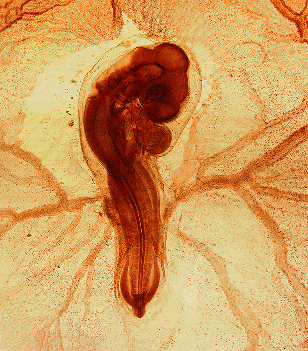 Chicken embryo, light micrograph Chicken embryo, light micrograph., by IKELOS GmbH Dr. Christopher B. Jackson Science Photo Library