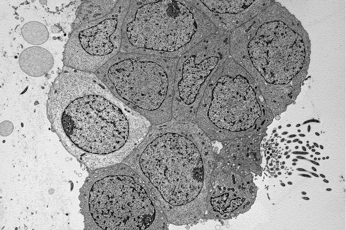 Respiratory epithelium, TEM Transmission electron micrograph  TEM  of a section through respiratory epithelium. The respiratory epithelium is the lining of the respiratory tract, which moistens and protects the airways. Mucous and cilia act to trap potential pathogens and foreign particles, preventing infection., by IKELOS GmbH Dr. Christopher B. Jackson Science Photo Library