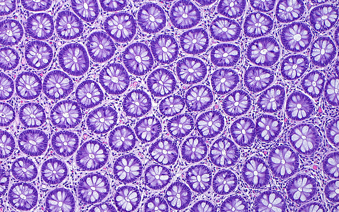 Colon epithelial crypt, light micrograph Light micrograph of cross sections of normal colon epithelial crypts, which resemble a  sea of flowers . This appearance is normal. The  petals  of the flowers are the goblet cells which secrete mucus. Haematoxylin and eosin stained tissue section. Magnification: 100x when printed at 10cm., by ZIAD M. EL ZAATARI SCIENCE PHOTO LIBRARY