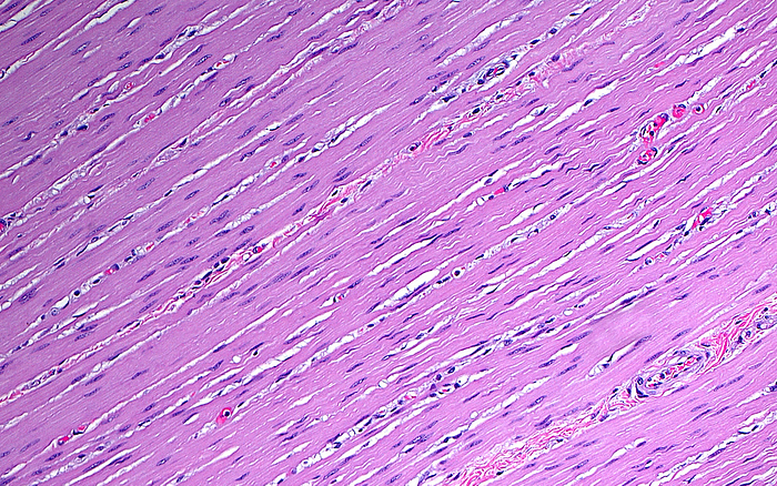 Smooth muscle in intestine, light micrograph Light micrograph of the smooth muscle cells in the wall of the large bowel. The muscle cells have long pink fibrous cytoplasm and blue spindle shaped nuclei. Interspersed small blood vessels are present between the muscle fibres. Haematoxylin and eosin stained tissue section. Magnification: 100x when printed at 10cm., by ZIAD M. EL ZAATARI SCIENCE PHOTO LIBRARY