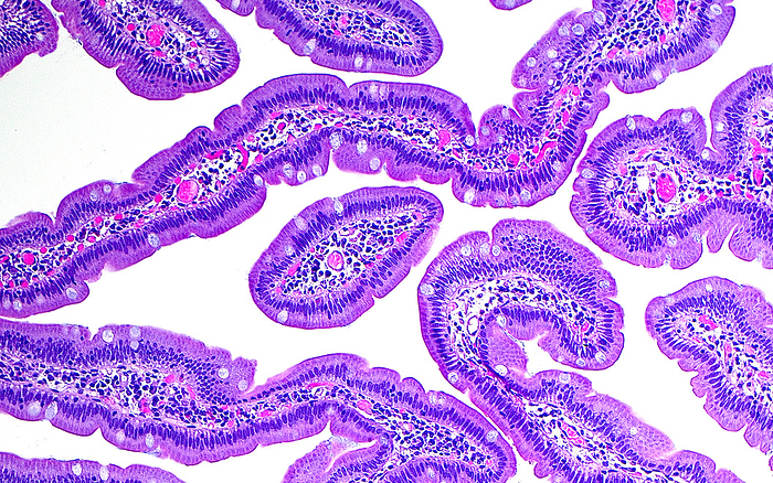 Intestinal villi, light micrograph Light micrograph of the villi  finger like structures  in the duodenum  first part of the small bowel . The villi are seen here horizontally. The inner portions of the villi have blood vessels  small bright pink circles  which take in the nutrients absorbed by the cells on the surface of the villi. Haematoxylin and eosin stained tissue section. Magnification: 100x when printed at 10cm., by ZIAD M. EL ZAATARI SCIENCE PHOTO LIBRARY