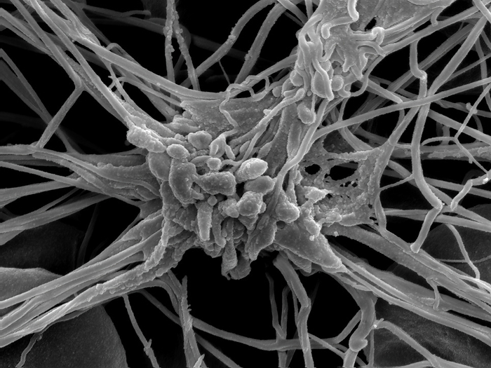 Platelet, SEM Scanning electron micrograph  SEM  showing an activated platelet  thrombocyte  trapped in a mesh of fibrin strands and erythrocytes during the The shell of the platelet has collapsed and numerous vesicles have been released into the wound area. The vesicles contain a large number of enzymes and growth factors, thereby attracting cells needed during the following stages of wound healing. Vessel wall injury The vesicles contain a large number of enzymes and growth factors, thereby attracting cells needed during the following stages of wound healing. Platelets and fibrin combine to form a blood clot containing erythrocytes  red blood cells . Magnification: 15000 brains when printed at 10 centimetres wide. by PETER SCHUPBACH SCIENCE PHOTO LIBRARY