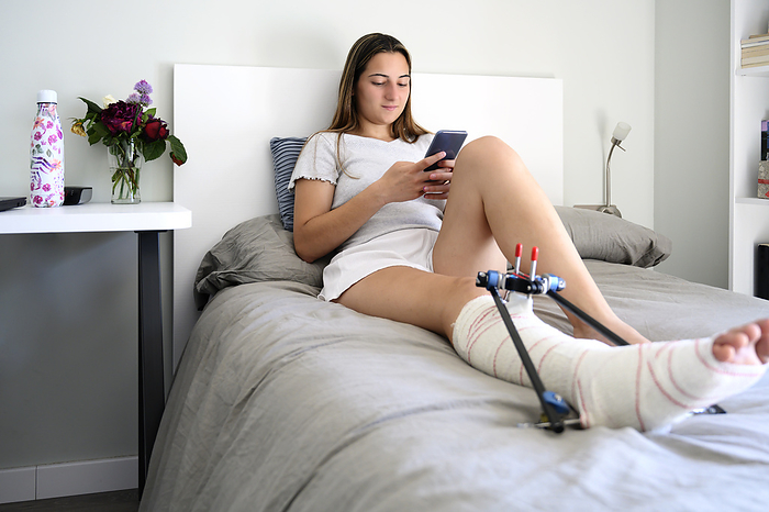 Young woman with broken leg lying on bed while using smartphone