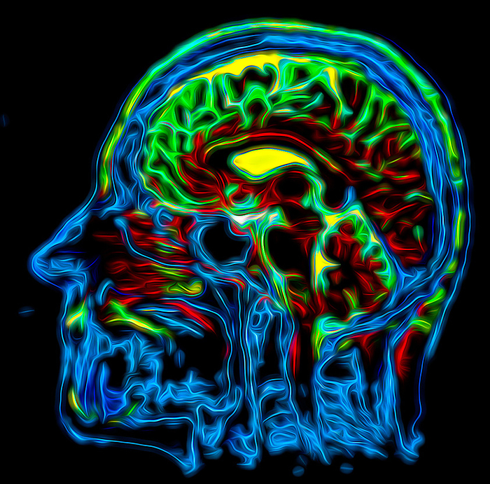 Healthy head and brain, MRI scan Coloured magnetic resonance imaging  MRI  scan of a sagittal section through a healthy head, showing the brain., by VSEVOLOD ZVIRYK SCIENCE PHOTO LIBRARY