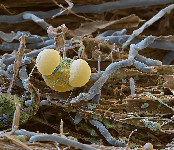 Pollen grain and fungi, SEM Coloured scanning electron micrograph  SEM  of a fir pollen grain surrounded by fungal hyphae on a piece of coarse woody debris. Fungal hyphae have already grown on the pollen grain itself. In humid weather a small pollen grain that falls on a forest floor disappears after a few days. It is quickly processed to humus by fungi and bacteria. Specimen from the Northern Black forest, Germany. Magnification: x400 when printed at 15cm wide., by EYE OF SCIENCE SCIENCE PHOTO LIBRARY