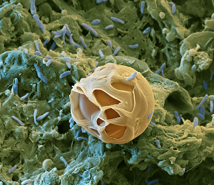 Dormant golden brown alga, SEM Coloured scanning electron micrograph  SEM  of a dormant cyst of a golden brown alga  class Chrysophyceae  from wet soil in the Northern Black Forest National Park, Germany. It is surrounded by bacteria. Chrysophyceae are micro algae with flagella that are used for locomotion. In adverse conditions they form cysts contained in a siliceous membrane and become dormant. Magnification: x5000 when printed at 15cm wide., by EYE OF SCIENCE SCIENCE PHOTO LIBRARY