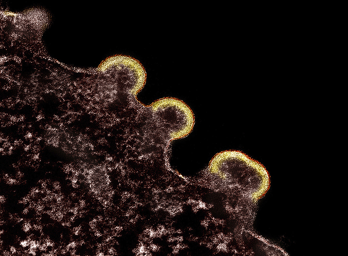 HIV particles budding from cell, TEM Coloured transmission electron micrograph  TEM  of HIV 1 particles  yellow outline  budding from the membrane of a host T cell. HIV  human immunodeficiency virus  attacks CD4  T lymphocytes  specialised white blood cells , which are crucial to the body s immune system. It enters the cell and makes many copies of itself, which then destroy the cell as they emerge through its membrane. This severely weakens the immune system, causing AIDS  acquired immunodeficiency syndrome ., by NIAID NATIONAL INSTITUTES OF HEALTH SCIENCE PHOTO LIBRARY
