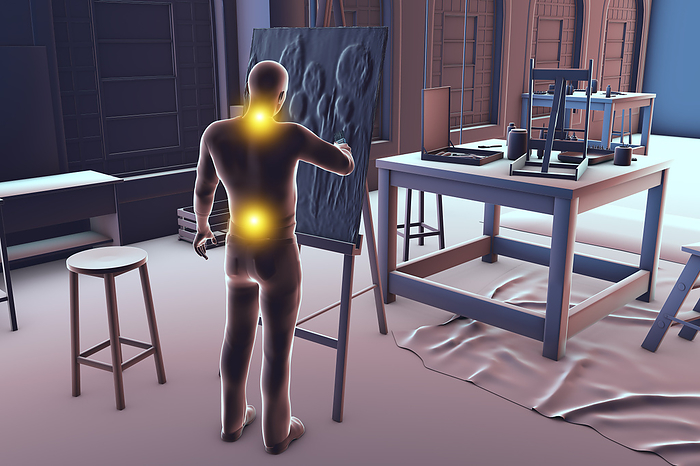 Artist with back and neck pain, illustration Illustration of a male artist painting on canvas in his studio while experiencing back and neck pain, which are common musculoskeletal disorders among artists., by KATERYNA KON SCIENCE PHOTO LIBRARY