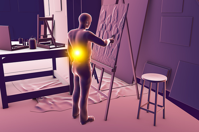 Artist with back pain, illustration Illustration of a male artist painting on canvas in his studio while experiencing back pain, which is a common musculoskeletal disorder among artists., by KATERYNA KON SCIENCE PHOTO LIBRARY