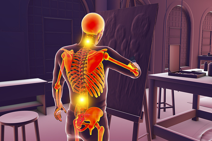 Artist with back and neck pain, illustration Illustration of a male artist with highlighted skeleton painting on canvas in his studio while experiencing back and neck pain, which are common musculoskeletal disorders among artists., by KATERYNA KON SCIENCE PHOTO LIBRARY