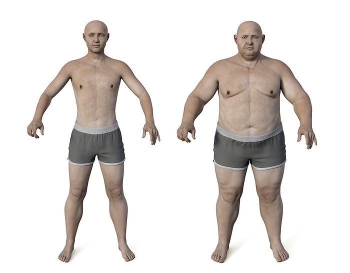 Man before and after gaining weight, illustration Transformation of an obese man s body. Computer illustration comparing man s appearance before and after significant weight gain., by KATERYNA KON SCIENCE PHOTO LIBRARY