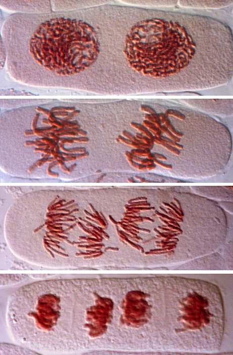 Mitosis in binucleate cells, light micrograph Differential interference contrast  DIC  light micrograph of onion  Allium cepa  meristematic cells, each with two nuclei, during mitosis  nuclear division . Mitosis is the formation of two daughter nuclei from one parent nucleus. At top the cell is in prophase, the nuclear envelopes dissolve and the chromosomes  red  condense. Second from top the cell is in metaphase, with the chromosomes aligned in a row. The chromosomes start to move to opposite poles, guided by microtubules, during anaphase  second from bottom . At bottom, the cell is in telophase. The separated chromosomes have moved to opposite sides and four new nuclei form around them. Orcein staining., by DR. JUAN F. GIMENEZ ABIAN   SCIENCE PHOTO LIBRARY