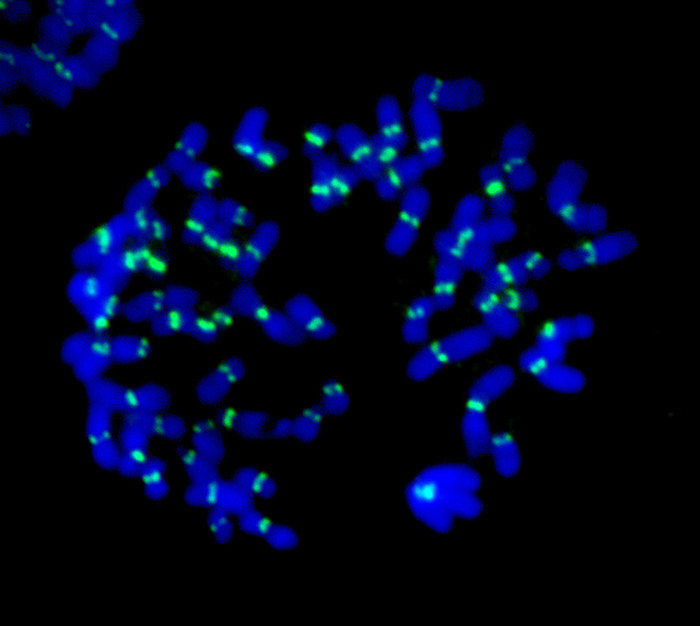 Human chromosomes, light micrograph Fluorescent light micrograph of human chromosomes. Fluorescent markers have been used to highlight DNA  deoxyribonucleic acid, blue  and kinetochores  green . During mitosis  nuclear division , the formation of two daughter nuclei from one parent nucleus, the spindle apparatus that separates  sister chromatids attaches to the chromosomes via the kinetochores. Two identical chromatids make up one chromosome, so each cell retains a copy of the parent cell s genetic information., by DR. JUAN F. GIMENEZ ABIAN   SCIENCE PHOTO LIBRARY