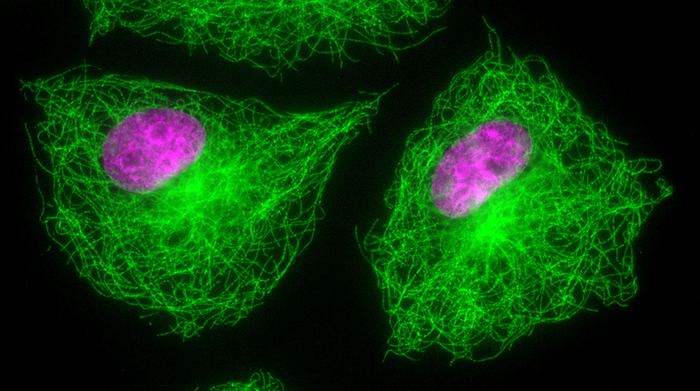 Mitosis, light micrograph Fluorescent light micrograph of cells in interphase of mitosis  nuclear division . Mitosis is the formation of two daughter nuclei from one parent nucleus. Fluorescent markers have been used to highlight alpha tubulin  green , a component of microtubules, and DNA  deoxyribonucleic acid, pink . During interphase the nucleus  pink  is clearly visible. As the cell moves into the next stage of mitosis the nuclear envelope will dissolve and the chromosomes condense., by DR. JUAN F. GIMENEZ ABIAN   SCIENCE PHOTO LIBRARY