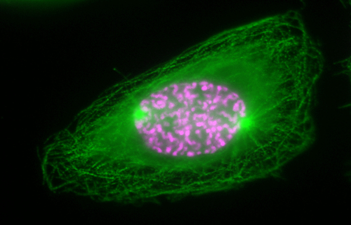 Mitosis, light micrograph Fluorescent light micrograph of a cell in prophase of mitosis  nuclear division . Mitosis is the formation of two daughter nuclei from one parent nucleus. Fluorescent markers have been used to highlight alpha tubulin  green , a component of microtubules, and DNA  deoxyribonucleic acid, pink . During prophase the nuclear envelope dissolves and the chromosomes condense., by DR. JUAN F. GIMENEZ ABIAN   SCIENCE PHOTO LIBRARY
