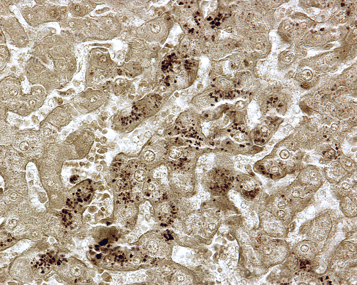 Lipid droplets in liver cells, light micrograph Lipid droplets in liver cells, light micrograph. The normal liver cells, or hepatocytes, contain lipid droplets. The droplets are more frequent near the central vein of the hepatic lobules, which can be demonstrated using osmium tetroxide as fixative. In steatosis or fatty liver disease, the amount of lipid droplets is pathologically very increased., by JOSE CALVO   SCIENCE PHOTO LIBRARY