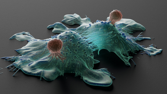 CAR T cell therapy, illustration Illustration of T cells  brown  attacking cancer cells  blue . CAR T therapy is a type of immunotherapy that genetically modifies a patient s own T cells to recognize and destroy cancer cells., by THOM LEACH   SCIENCE PHOTO LIBRARY