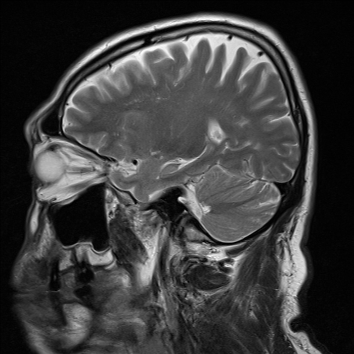 Healthy human brain, MRI scan Sagittal T2 magnetic resonance imaging  MRI  scan of healthy human brain., by RAJAAISYA SCIENCE PHOTO LIBRARY