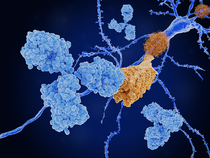 Antibody bound to an amyloid beta peptide, illustration Illustration of a monoclonal antibody  light blue  bound to an amyloid beta peptide  orange . Misfolded amyloid beta peptides aggregate and form amyloid plaques that are characteristic of Alzheimer s disease. Monoclonal antibodies are being developed as immunotherapy treatments for Alzheimer s disease., by JUAN GAERTNER SCIENCE PHOTO LIBRARY