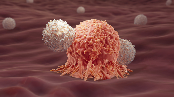T cells attacking a cancer cell, illustration Illustration of T cells attacking a cancer cell., by ARTUR PLAWGO   SCIENCE PHOTO LIBRARY