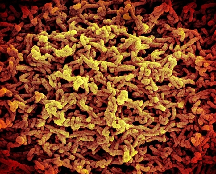 Marburg virus particles, SEM Coloured scanning electron micrograph  SEM  of Marburg virus particles  red and yellow , both budding and attached, to the surface of an infected cultured cell. This tubular RNA  ribonucleic acid  virus causes Marburg virus disease in humans and non human primates. Symptoms of this rare and often fatal disease include high fever, headache, muscle pain, rash, nausea, diarrhoea and haemorrhaging. The virus was first documented in 1967 when there were simultaneous outbreaks of haemorrhagic fever in laboratories in Marburg and Frankfurt, Germany, and in Belgrade, Yugoslavia. The outbreak was traced to vervet monkey tissue used in research., by NIAID SCIENCE PHOTO LIBRARY