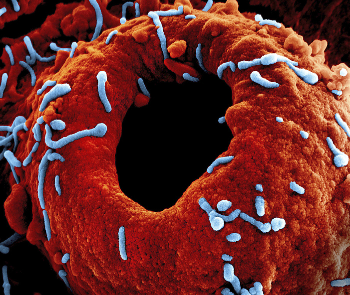 Marburg virus particles, SEM Coloured scanning electron micrograph  SEM  of Marburg virus particles  blue , both budding and attached, to the surface of an infected cultured cell  red . This tubular RNA  ribonucleic acid  virus causes Marburg virus disease in humans and non human primates. Symptoms of this rare and often fatal disease include high fever, headache, muscle pain, rash, nausea, diarrhoea and haemorrhaging. The virus was first documented in 1967 when there were simultaneous outbreaks of haemorrhagic fever in laboratories in Marburg and Frankfurt, Germany, and in Belgrade, Yugoslavia. The outbreak was traced to vervet monkey tissue used in research., by NIAID SCIENCE PHOTO LIBRARY