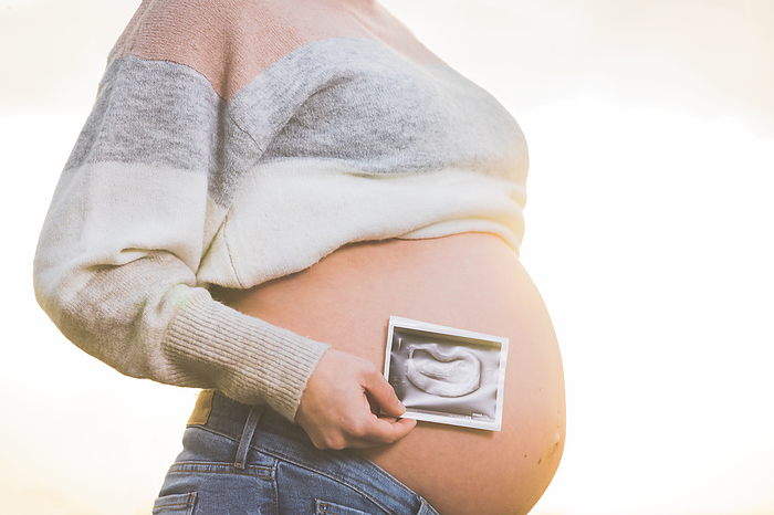 A pregnant woman is holding a photo of her baby Ultrasound , outdoors. A pregnant woman is holding a photo of her baby Ultrasound , outdoors.