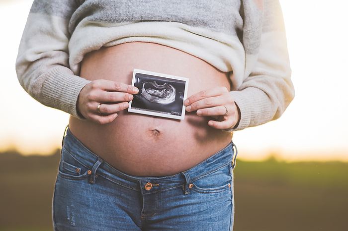 A pregnant woman is holding a photo of her baby Ultrasound , outdoors. A pregnant woman is holding a photo of her baby Ultrasound , outdoors.