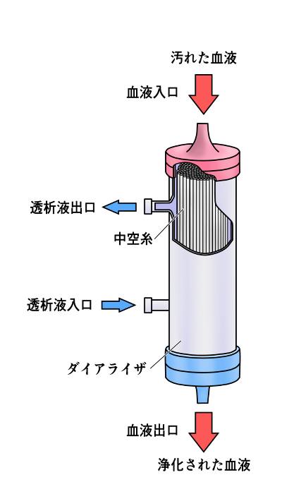 Illustration of dialyzer image