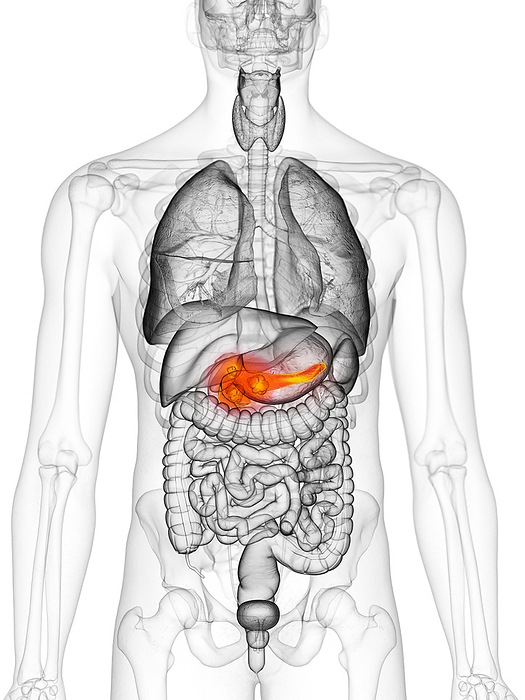 Pancreas cancer, illustration Pancreas cancer, illustration., by SEBASTIAN KAULITZKI SCIENCE PHOTO LIBRARY