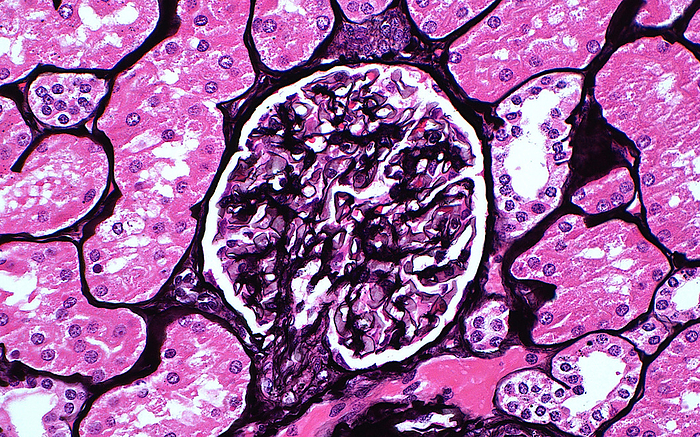 Glomerulus, light micrograph Light micrograph of a normal human glomerulus  central round structure  stained with a Jones silver stain. The sliver stains the basement membrane of the capillaries  small blood vessels  inside the glomerulus, as well as the capsule  outer boundary  of the glomerulus in black. The stain also outlines the boundaries of the surrounding kidney tubules in black. The tubules themselves contain tubular epithelial cells that stain pink. Magnification: x200 when printed at 10cm wide., by ZIAD M. EL ZAATARI SCIENCE PHOTO LIBRARY