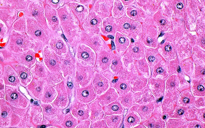 Liver cells, light micrograph Light micrograph of human liver cells. The cells have round nuclei  dark blue circles  and are polygonal in shape with abundant cytoplasm  dark pink surrounding nuclei . A few red blood cells  bright red  are seen in between the liver cells. Haematoxylin and eosin stained tissue section. Magnification: x400 when printed at 10cm wide., by ZIAD M. EL ZAATARI SCIENCE PHOTO LIBRARY