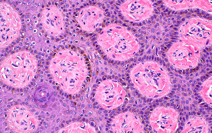 Skin epidermis, light micrograph Light micrograph of the skin epidermis, the outermost layer of skin, cut in cross section. The skin epidermis contains squamous cells  light purple  arranged around papillae  pink circles  that are protrusions of the underlying connective tissue into the epidermal layer. Since the papillae are roughly cylindrical in shape, they appear as circles when cut in cross section. Haematoxylin and eosin stained tissue section. Magnification: x200 when printed at 10cm wide., by ZIAD M. EL ZAATARI SCIENCE PHOTO LIBRARY