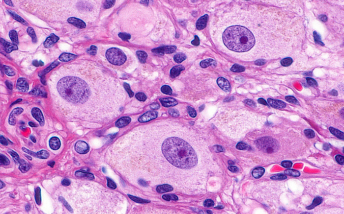 Nerve ganglion cells, light micrograph Light micrograph of the bodies of cells in a nerve ganglion. The cell bodies have round nuclei  purple ovals  with prominent nucleoli  dark pink to purple dots inside purple circles  and abundant cytoplasm  light pink areas around nuclei . The cytoplasm contains Nissl granules  very small pink grains  and scattered lipochrome pigment  light brown grains . Ganglion cells are found at various locations throughout the body and function in the autonomic nervous system, or the system of nerves that operate independently of voluntary control. Haematoxylin and eosin stained tissue section. Magnification: x600 when printed at 10 cm., by ZIAD M. EL ZAATARI SCIENCE PHOTO LIBRARY