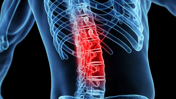 Painful lumbar spine, illustration Painful lumbar spine, illustration., by SEBASTIAN KAULITZKI SCIENCE PHOTO LIBRARY