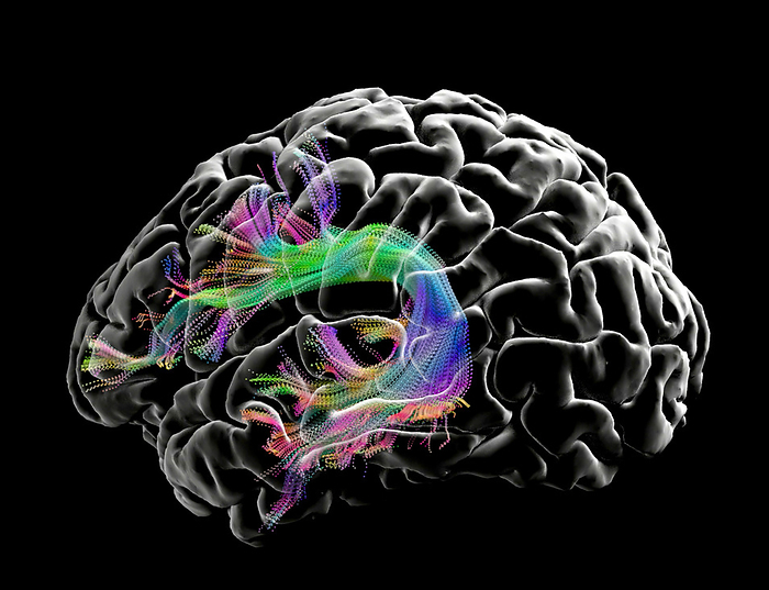 Arcuate fasciculus, DTI MRI scan Coloured diffusion tensor imaging  DTI  magnetic resonance imaging  MRI  scan showing white matter fibres in the arcuate fasciculus of the brain. The front of the brain is at left. The arcuate fasciculus connects the frontal, parietal, and temporal lobes. Diffusion tensor imaging measures the direction of water diffusion, which in the brain reveals the orientation of nerve fibres. Red fibres have a left to right orientation, green a front to back orientation and blue an up and down orientation., by MARK AND MARY STEVENS NEUROIMAGING AND INFORMATICS INSTITUTE SCIENCE PHOTO LIBRARY