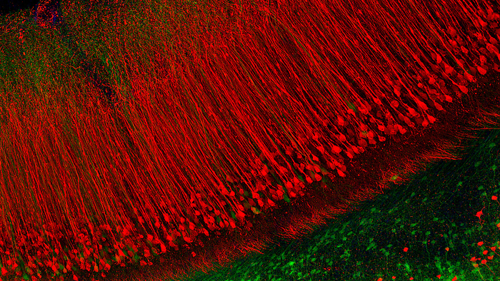 Mouse neuronal fibres, fluorescent micrograph Fluorescent light micrograph of neuronal  nerve cell  fibres in the hippocampus of the brain of a mouse. The hippocampus is responsible for long term memory., by MARK AND MARY STEVENS NEUROIMAGING AND INFORMATICS INSTITUTE SCIENCE PHOTO LIBRARY
