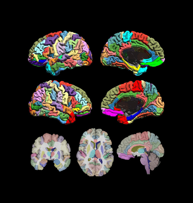 Mid cortical surface brain areas, fMRI Map of mid cortical surface brain areas based on functional magnetic resonance imaging  fMRI  scan data. This is part of the USCBrain atlas, which uses both anatomical and functional information to subdivide the brain s cerebral cortex into regions., by MARK AND MARY STEVENS NEUROIMAGING AND INFORMATICS INSTITUTE SCIENCE PHOTO LIBRARY