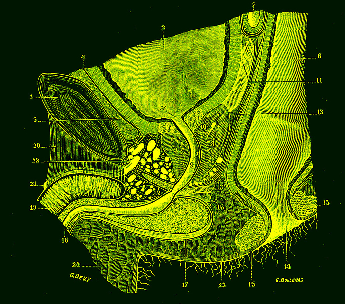Male pelvic anatomy, illustration Illustration of section through the male pelvis. At top centre is the urinary bladder  2 , which stores urine before it is expelled from the body via the urethra  9 , which runs along centre of the penis. Below the bladder is the prostate gland  8 , which produces a fluid that forms part of the semen, and sits around the urethra. At right is the rectum  6 , with the anus  14  at bottom right. From Traite d Anatomie Humaine, Vol 4  1905  by French anatomist Leo Testut  1849 1925 ., by COLLECTION ABECASIS SCIENCE PHOTO LIBRARY
