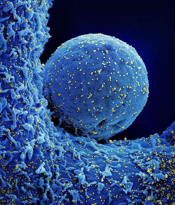Cell infected by SARS CoV 2 virus particles, SEM Coloured scanning electron micrograph  SEM  of a cell  blue  infected with the Omicron strain of the SARS CoV 2 virus particles  yellow  from a US patient sample. SARS CoV 2 causes the respiratory infection Covid 19, which can lead to fatal pneumonia., by NIAID NATIONAL INSTITUTES OF HEALTH SCIENCE PHOTO LIBRARY