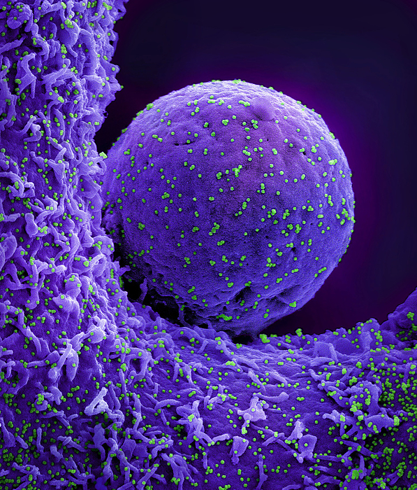 Cell infected by SARS CoV 2 virus particles, SEM Coloured scanning electron micrograph  SEM  of a cell  purple  infected with the Omicron strain of the SARS CoV 2 virus particles  green  from a US patient sample. SARS CoV 2 causes the respiratory infection Covid 19, which can lead to fatal pneumonia., by NIAID NATIONAL INSTITUTES OF HEALTH SCIENCE PHOTO LIBRARY