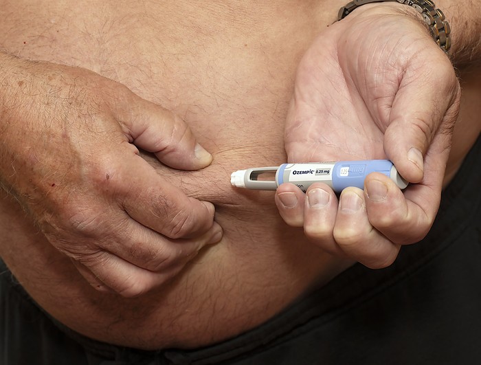 Semaglutide diabetes medication injection Male patient using a pre filled pen to inject himself with Semaglutide diabetes medication. Marketed as Ozempic, this is a  glucagon like peptide 1  GLP 1  analogue that is used to treat diabetes and is used for weight management. It increases the production of insulin, the hormone that lowers blood sugar levels, while also suppressing secretion of glucagon, the hormone that raises blood sugar levels. It also reduces hunger and slows gastric emptying. Ozempic is administered by injection into the thigh, abdomen or upper arm., by SCIENCE PHOTO LIBRARY