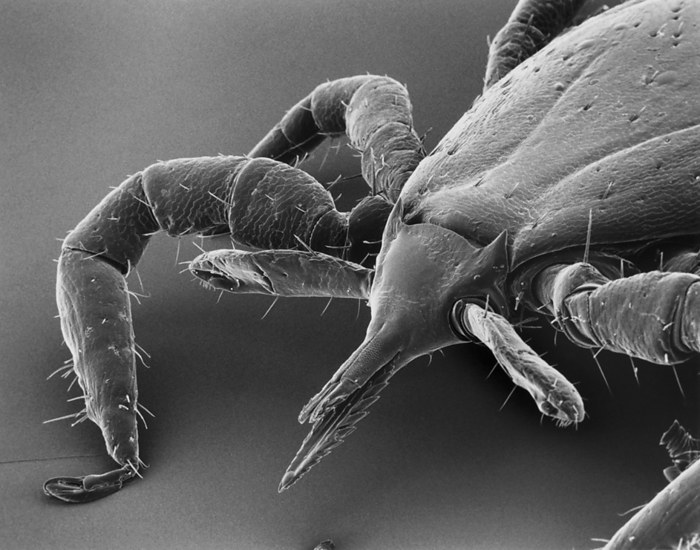 Microscopic view of a deer tick (Ixodes dammini) magnified about 90 times.; U.S., by Darlyne Murawski / Design Pics