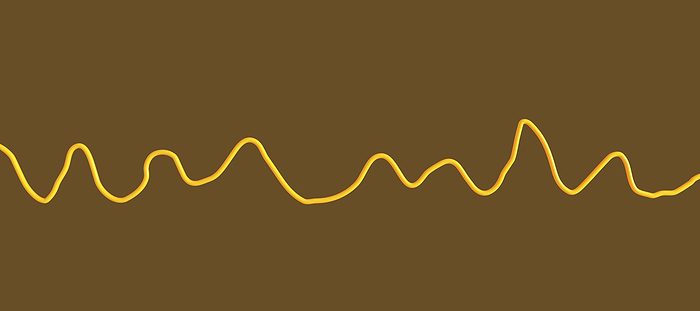 Ventricular fibrillation heartbeat rhythm, illustration Illustration of an electrocardiogram  ECG  displaying the chaotic rhythm of ventricular fibrillation, a life threatening cardiac arrhythmia., by KATERYNA KON SCIENCE PHOTO LIBRARY