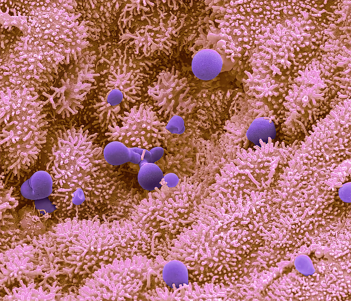 Uterus endometrium, SEM Uterus endometrium. Coloured Scanning Electron Micrograph  SEM  of the surface epithelium  endometrium  of the human uterus in the secretory phase. The exposed epithelial cell surfaces are covered in numerous microvilli. The endometrium containing openings to tubular uterine glands beneath the epithelial surface.The glands produced granules of mucus, composed of proteins and sugars, which represent the nutritive elements for a possible fertilised ovum. The secretory phase is triggered during the ovarian cycle by the hormones oestrogen and progesterone which are secreted by the ovary. Magnification: x400 when printed at 10 cm wide., by STEVE GSCHMEISSNER SCIENCE PHOTO LIBRARY