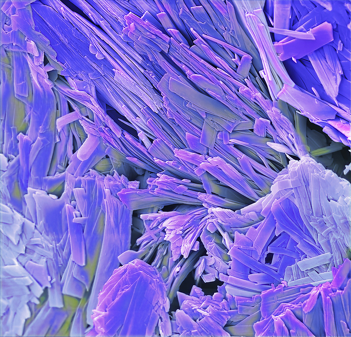 Antibiotic crystal, SEM Antibiotic crystals. Coloured scanning electron micrograph  SEM  of crystals of the antibiotic ciprofloxacin, a broad spectrum antibiotic of the fluoroquinolone class. Ciprofloxacin is used mainly to treat infections of the gastrointestinal and genitourinary tract, as well as respiratory tract infections. It is also active against typhoid fever, some sexually transmitted diseases, infectious diarrhoea, septicaemia, and inhalational anthrax, and is used also as an antineoplastic agent. Magnification: x4000 when printed at 10cm wide., by STEVE GSCHMEISSNER SCIENCE PHOTO LIBRARY