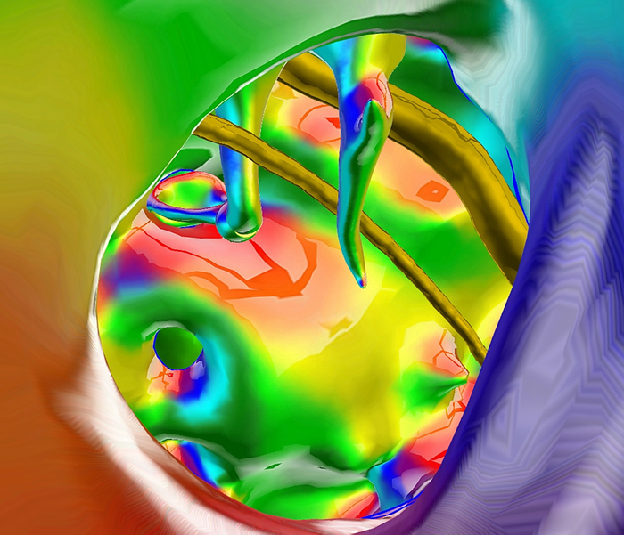 Middle ear, 3D CT and MRI scans Coloured 3D composite computed tomography  CT  and magnetic resonance imaging  MRI  scans of a view along the right auditory canal to the middle ear. The eardrum has been digitally removed. The front of the body is at right. The two pointed structures at upper centre are two of the bones of the middle ear, the malleus  centre  and the incus  left . The incus is attached to the third bone, the stapes  oval . These bones mechanically transmit sounds from the eardrum  not seen  to the fluid filled organs of the inner ear. The two thread like structures across upper right are the chorda tympani nerve  thinner  and the facial nerve  thicker ., by K H FUNG SCIENCE PHOTO LIBRARY